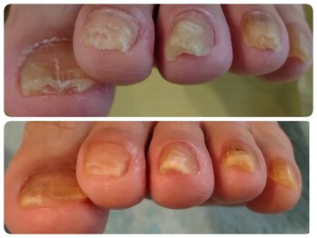 フットケアサロン ラビフット(Rabbi foot)/足裏だけでなく爪も大事です
