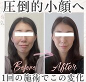 アシュネ(Axiune)