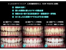 シャルム(CHARME)の雰囲気（歯科助手や歯科衛生士などプロも多くご来店※18歳以上から可能）