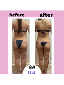 ビューティーショップ リアン(RIAN)/全身メニュー