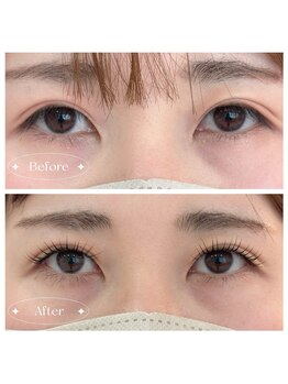 グレイス(GRACE)/下がりまつげさんもお任せ下さい