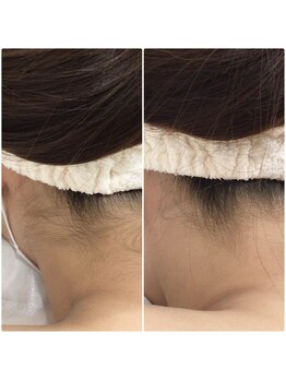 ベルネージュ(Belle Neige)/