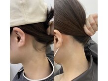 ミース 長野店/うなじ矯正◆ビフォーアフター