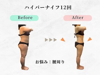 ウェリナ 一宮院/小顔矯正/骨盤矯正/痩身整体