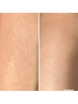 マイレ 銀座(MAILE)/膝下