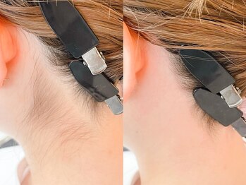 ネリネ 天神(nerine)/うなじ美人☆ワックス脱毛