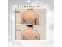 27コスメ銀座の雰囲気（筋膜リリースメニューが新登場！3回でこの変化☆肩こりケア☆）