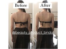 ビューティープロダクト(Beauty product)の雰囲気（ブライダルエステ 2回【痩リンパBody Design＋超音波】）