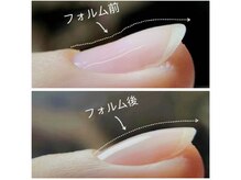 健康の為パラジェル実施、オフ：ジェルー層残しの「フィルイン」