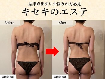 デア グレース(Dea grace)