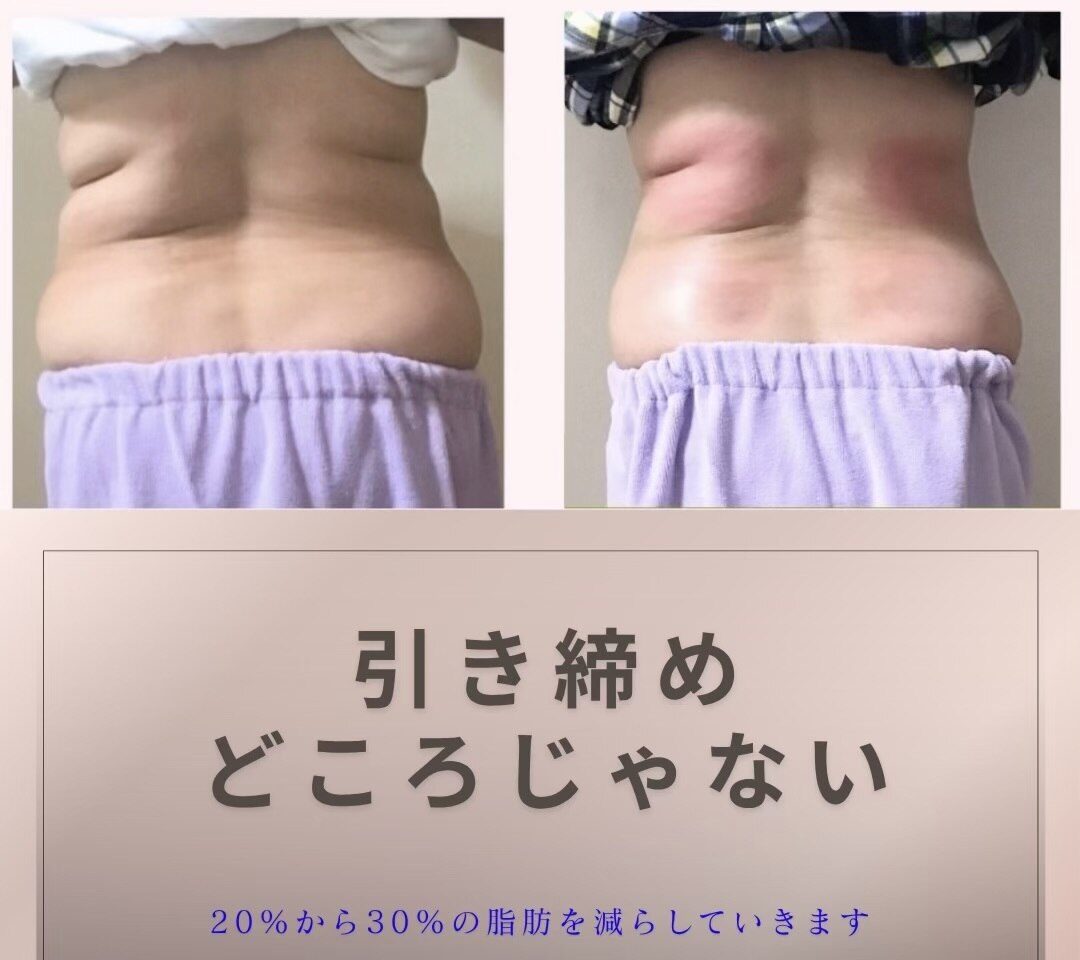 スリム(SLIM by lily of the valley)｜ホットペッパービューティー