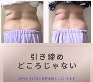 スリム(SLIM by lily of the valley)