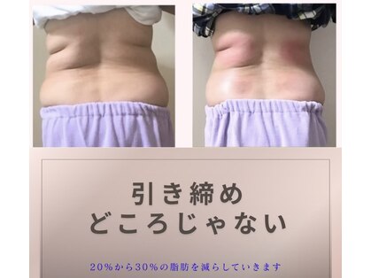 スリム(SLIM by lily of the valley)の写真