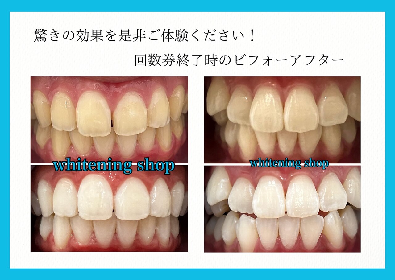 ホワイトニングショップ 八重瀬店｜ホットペッパービューティー