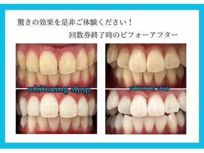 ホワイトニングショップ 八重瀬店の写真
