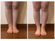 うつくし痩身 美サロン ゼットワン(Z-ONE)の写真/【浮腫み解消で美脚美人に♪】下半身筋膜リリースメディセルでお得に下半身スピード痩せ!!¥5800