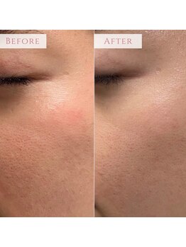 アンドニューリー(&NEWLY)/LDM×クリスティーナ