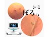 シミが多い方におすすめ★スポットシミケア【３０分当て放題】×7回　 ¥56000
