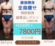 ダイエット サポート(DIET SUPPORT)