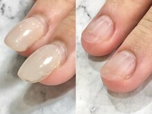 リファーレ(RIFARE)/【他店修正】他店様のお直しも◎