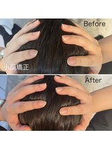 フレイヤ 恵比寿(Freyia)/【小顔矯正】