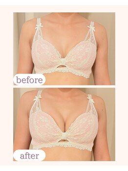 ワム(Wom)/産後ケア/ハリ・弾力復活/20代