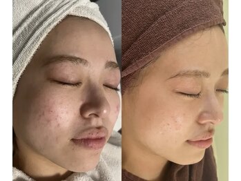 スリリアン 銀座/★お客さまビフォーアフター★