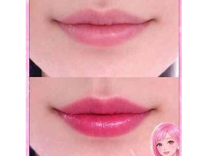 ベリッシマ(Bellissima)の写真