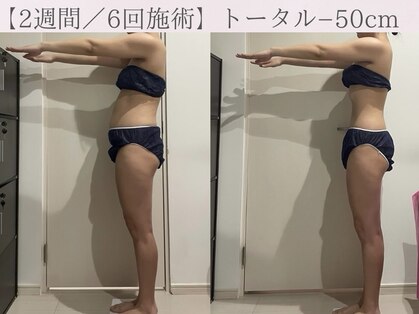 キララ(Kirara)の写真