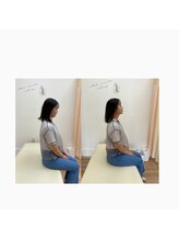 鍼灸整骨院ACT/ストレートネックを緩和します！