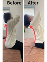 リライフ/Before/After