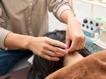 ハリカフェ(HARI CAFE)/美と健康を支える鍼施術