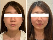 美容整体ウェリナ 名駅院/小顔矯正/骨盤矯正/美脚サロン