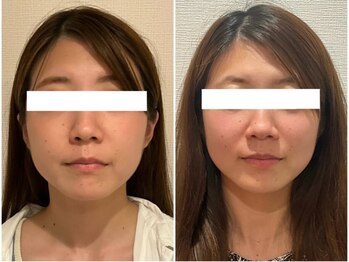 美容整体ウェリナ 名駅院/小顔矯正/骨盤矯正/美脚サロン