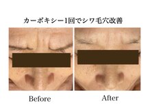 ナチュラーレ 天王寺店(Naturale)/美肌ニキビケア小顔フェイシャル