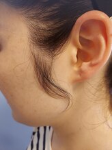 キアラ 麻布十番(Kiara)/もみあげ脱毛