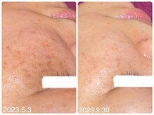 フォーチューン/お客様の感想♪