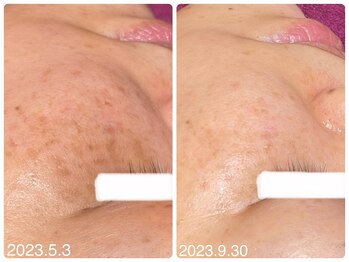 フォーチューン/お客様の感想♪