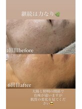 リュミエール(LUMIERE)/継続は力なり☆