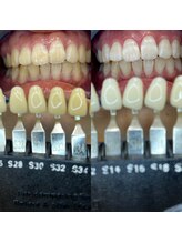 トウキョウスワーズ 池袋店(TOKYO SWRS)/#ホワイトニング #池袋 #渋谷