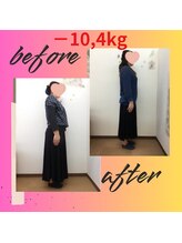 スーパースリムダイエット茅ヶ崎 茅ヶ崎整体院/3ヵ月－10,4ｋｇ減ダイエット♪