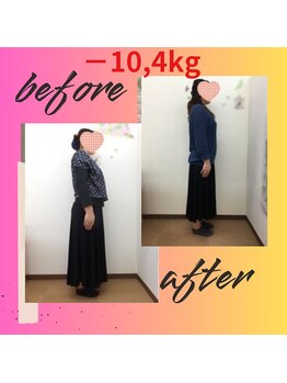 スーパースリムダイエット茅ヶ崎 茅ヶ崎整体院/3ヵ月－10,4ｋｇ減ダイエット♪