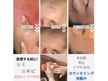 ネイルアンドビューティー モアリボン(Nail&Beauty More Libbon)