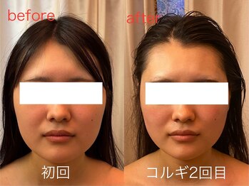 ビーキュート 神戸元町店(BE-CUTE)/コルギ2回目