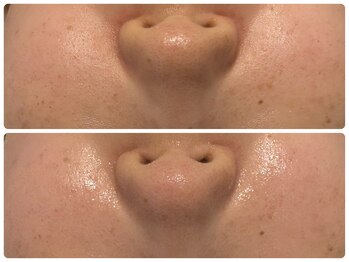 エフェクト 塚口店(effect)/before after