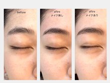 ネムリビト/ビフォーアフター／眉&顔Wax