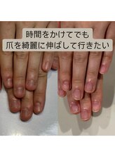 ティアラネイル 宇都宮/深爪矯正