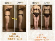 エメカシワ(Aimer KASHIWA)の雰囲気（【w高周波ハイパーナイフEX2】気持ちよさと効果どちらも実感♪）