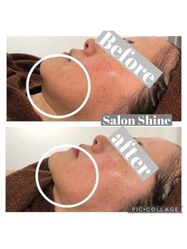 サロンシャイン(Salon Shine)/４０代女性REVIハーブ