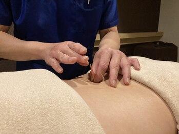 じゃぱん鍼灸りらく院 整骨院/